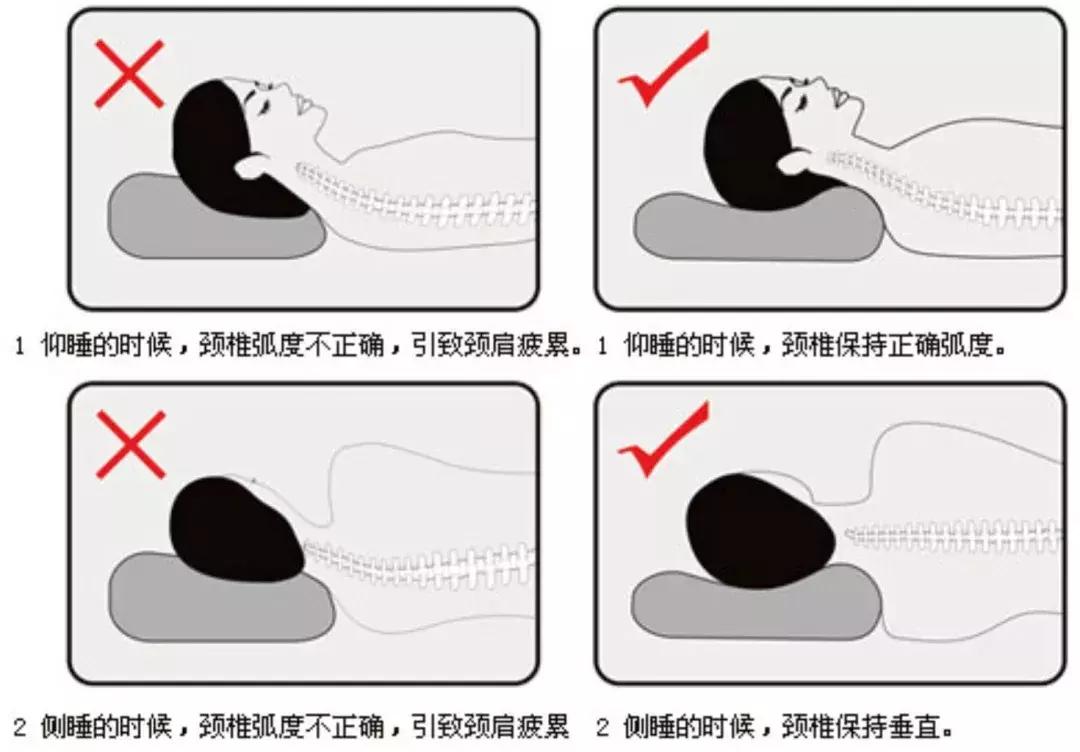 一觉醒来脖子僵得不能动,一觉醒来脖子全是汗怎么回事