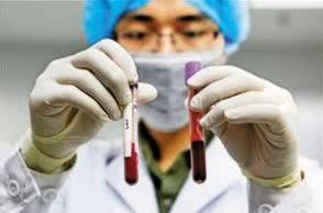 全球稀有的三种血型,全球三大稀有血型