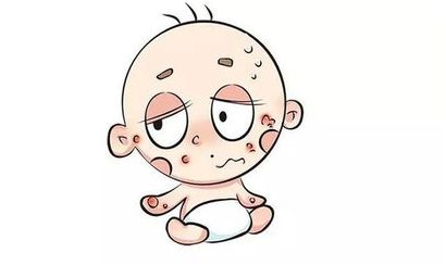 宝宝湿疹护理知识,宝宝湿疹护理视频大全