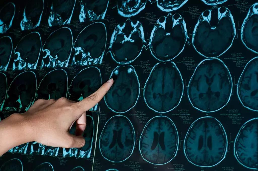 这18种医疗行为将被严查,医疗检查项目哪些可以报销