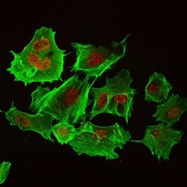 ihc免疫组化实验步骤及所需材料,免疫组化IHC实验步骤