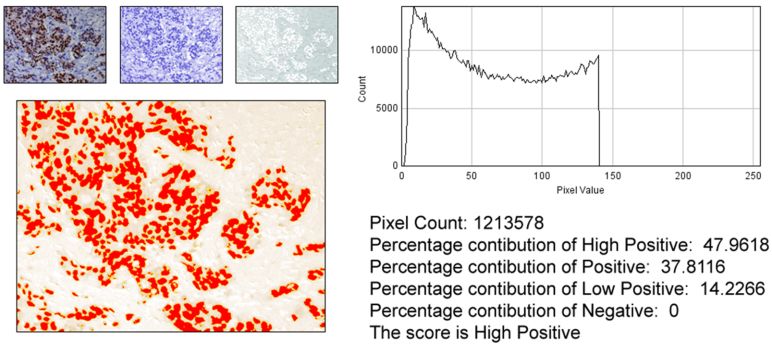 ihc免疫组化实验步骤及所需材料,免疫组化IHC实验步骤