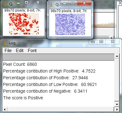 ihc免疫组化实验步骤及所需材料,免疫组化IHC实验步骤