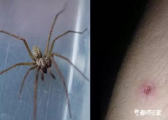 被马蜂蜇了的最快速处理办法,被马蜂蛰的100种方法