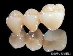 美牙仪是冷光好还是led好,美牙仪真的对牙齿有损伤吗