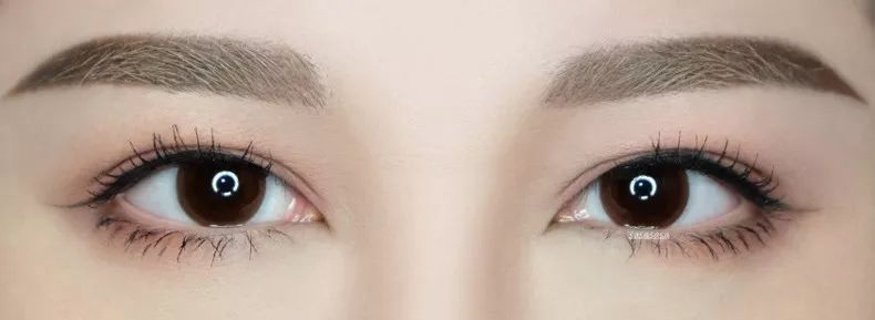 眼睛天生小怎么变大手术,眼睛天生小怎么办