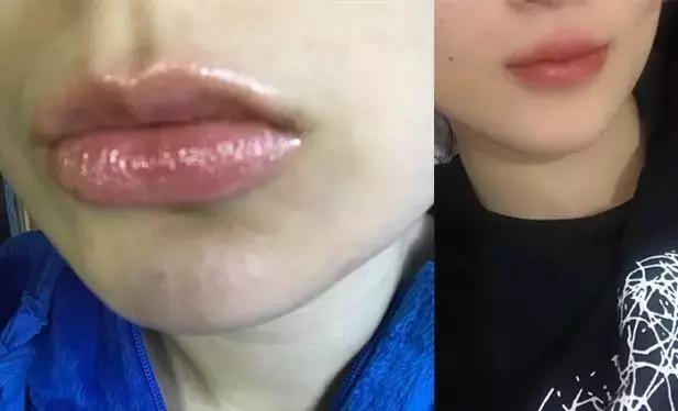 周迅嘴巴嘟嘟,周迅的嘴巴本来就是嘟的吗