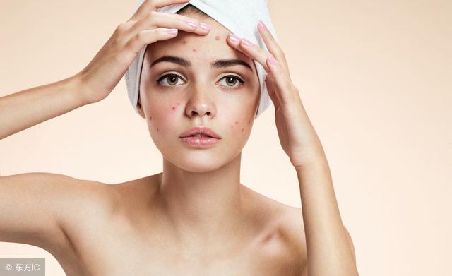 脸上螨虫多毛孔超级大怎么办,脸上螨虫过亿只需一招