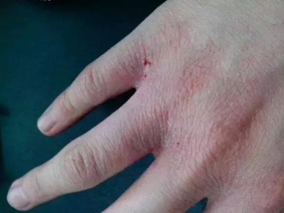 俄罗斯护肤品有多便宜,俄罗斯最好用的护肤品