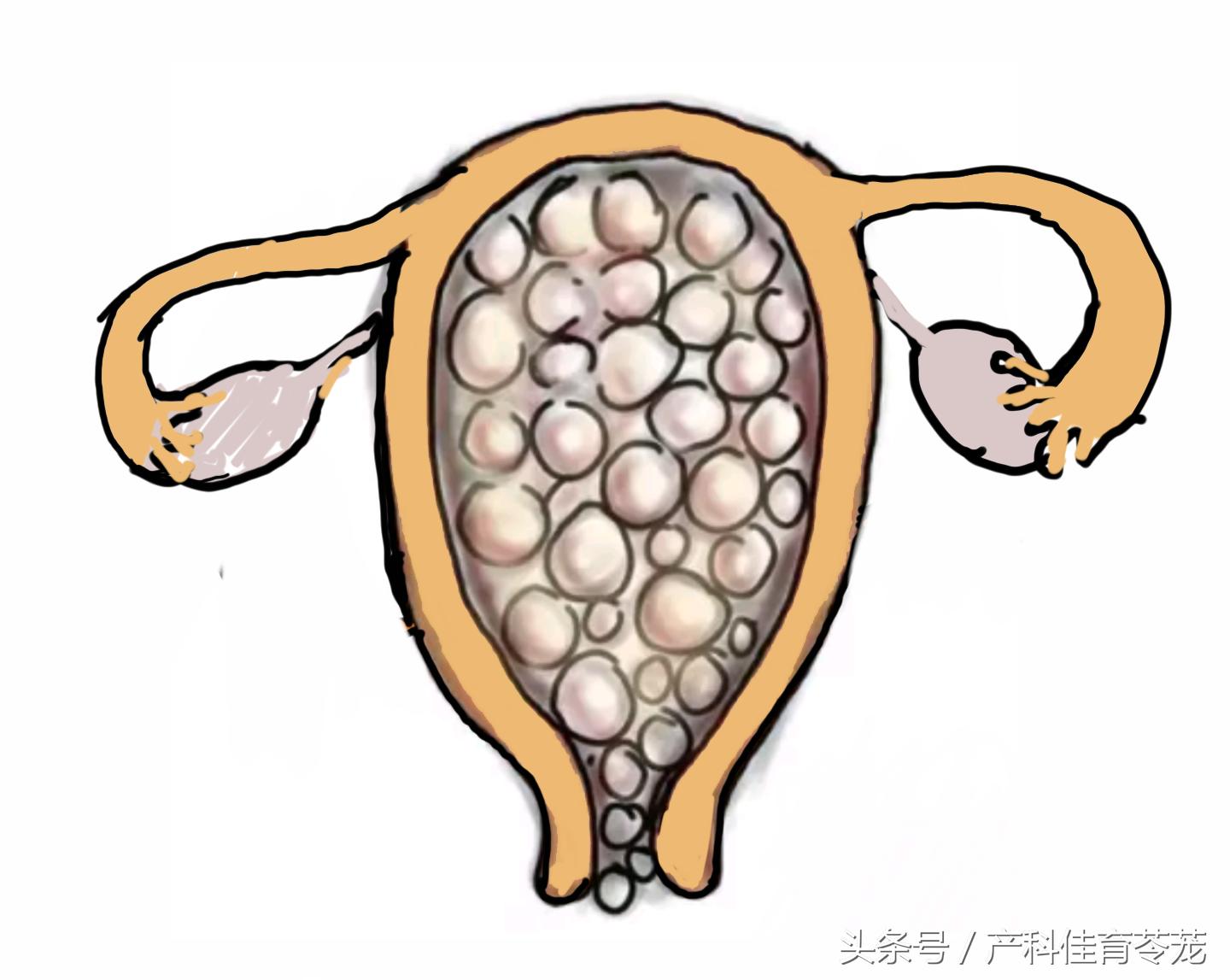 怀孕了出血，还吐得厉害，小心葡萄胎