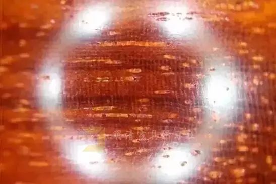 金星和牛毛纹图片,牛毛纹和棕眼图解