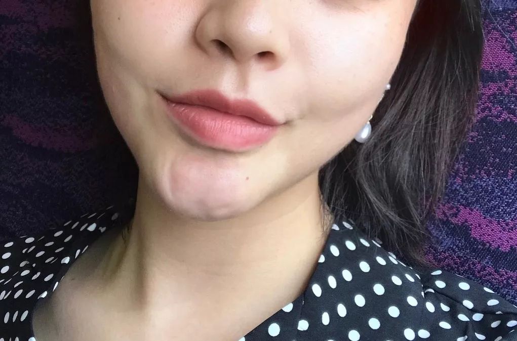 澳洲美白丸效果怎么样,澳洲美白丸28天测评真实