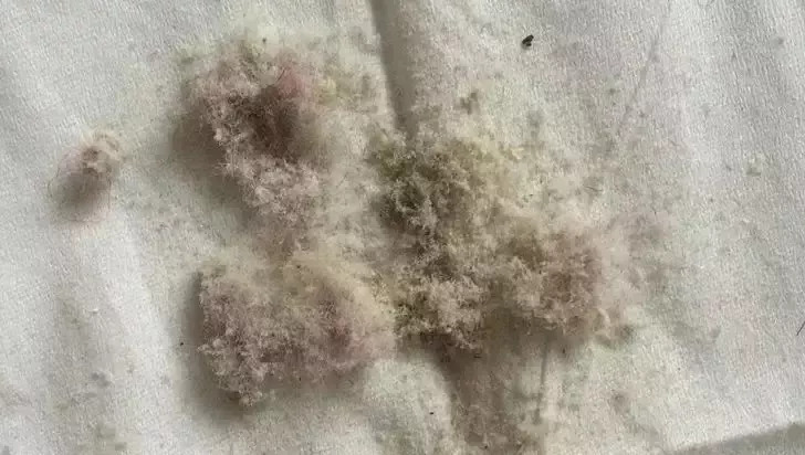 床上有螨虫身上痒用什么药来洗,身上痒可能床上有螨虫怎么解决啊