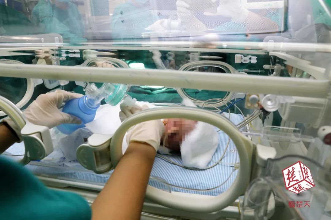 产检发现胎儿腹部包块,产检看到宝宝肚子上有个洞