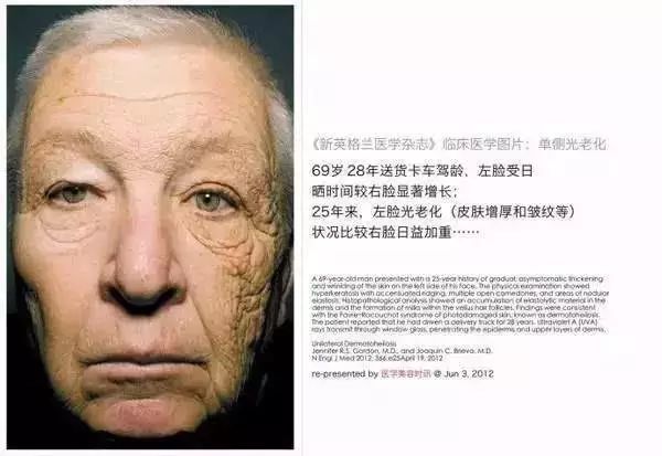 实用丨不防晒=变黑+变老！10款口碑防晒请收好！