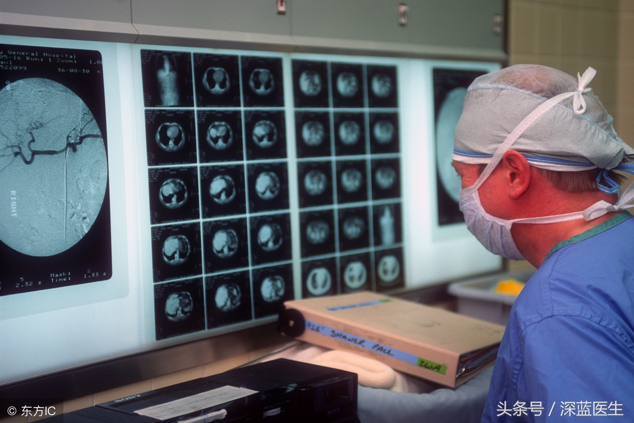 臧天朔怎么得肝癌,臧天朔肝癌怎么治