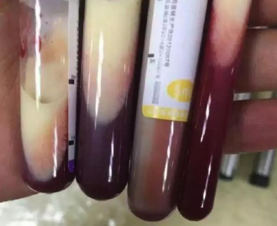 医生说饮食要有规律,专家说这样吃饭可以多活20年