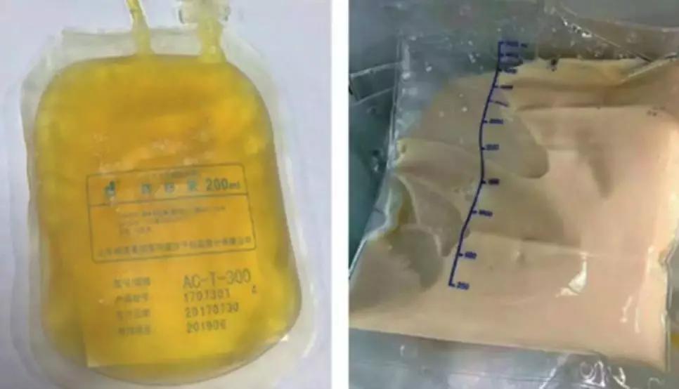 医生说饮食要有规律,专家说这样吃饭可以多活20年