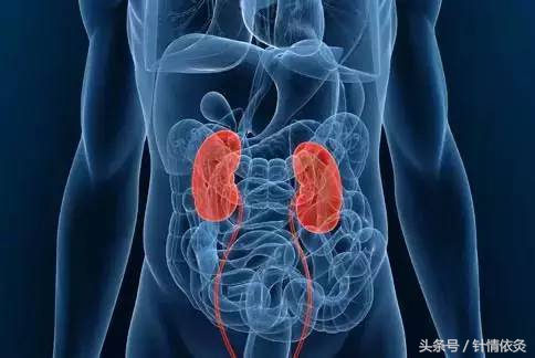 肾绞痛董氏针灸,肾绞痛针灸穴位