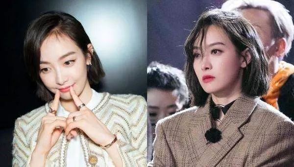 男人发际线后移怎么拯救,如何拯救发际线后移