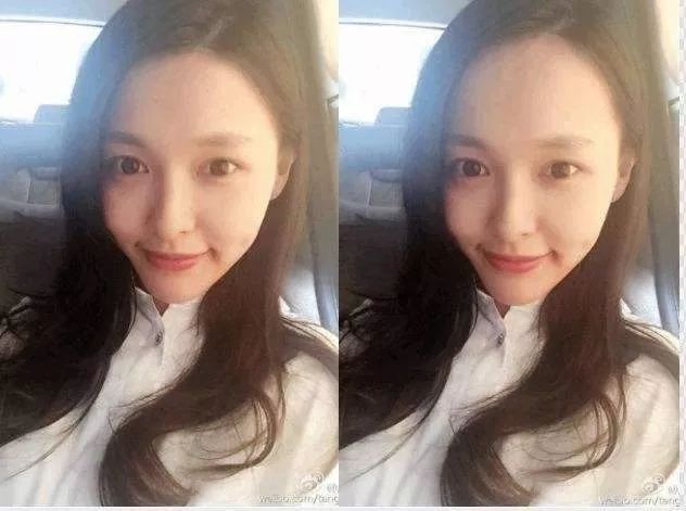 男人发际线后移怎么拯救,如何拯救发际线后移