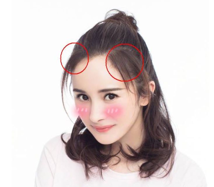 男人发际线后移怎么拯救,如何拯救发际线后移