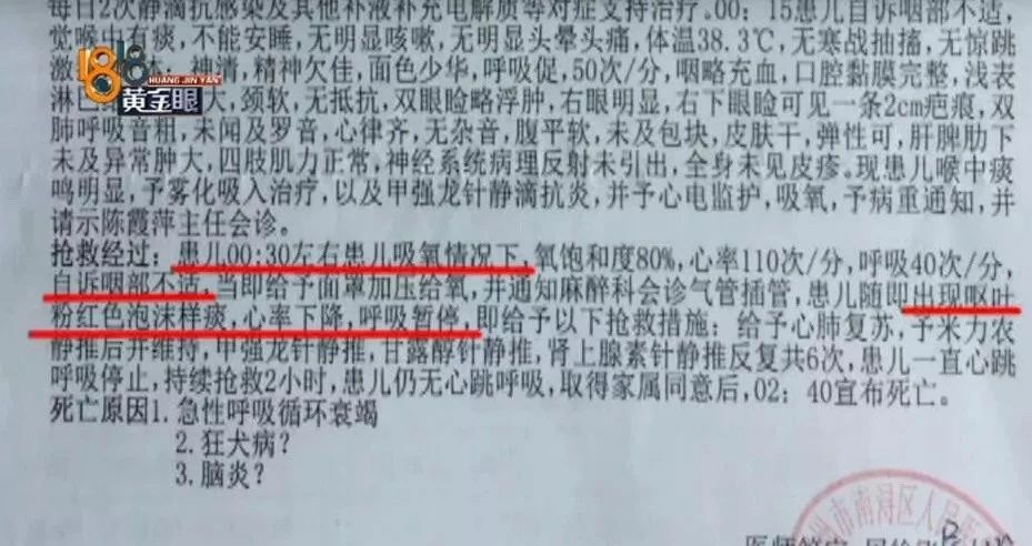 6岁小孩被狗咬13天后狂犬病发作,6岁小孩被狗咬了打狂犬疫苗