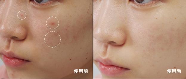 7秒卖1瓶！这款日本爆火单品，3分钟让大干皮变身“水宝宝”！