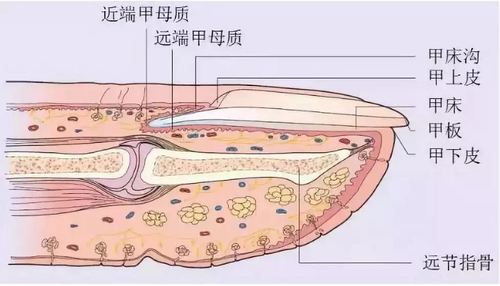 甲旁型灰指甲怎么治疗能彻底除根,灰指甲拔甲后更加难治疗