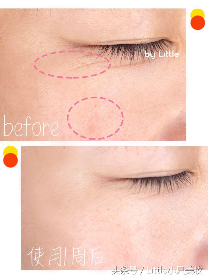 干皮缺水出油长痘用什么护肤,适合油痘肌换季干燥起皮的护肤品