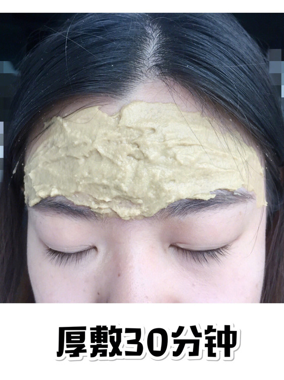 闭口消不下去,闭口挤不出来反而肿了多久能好