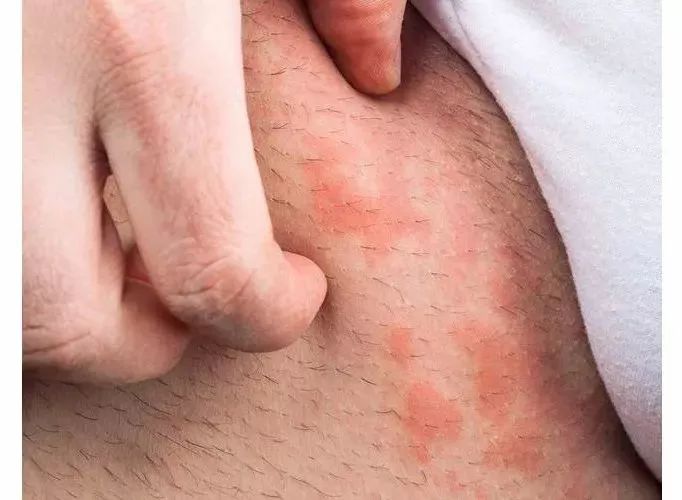 黑科技抗菌裤,大范围灭杀病毒黑科技