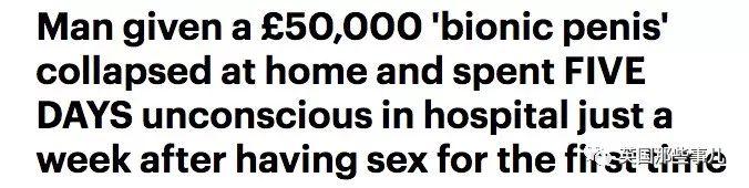 一出生就没了12个器官,一出生就没有肚脐