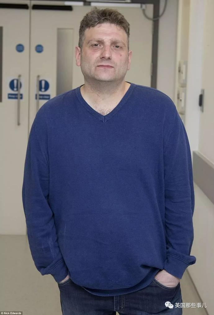 一出生就没了12个器官,一出生就没有肚脐