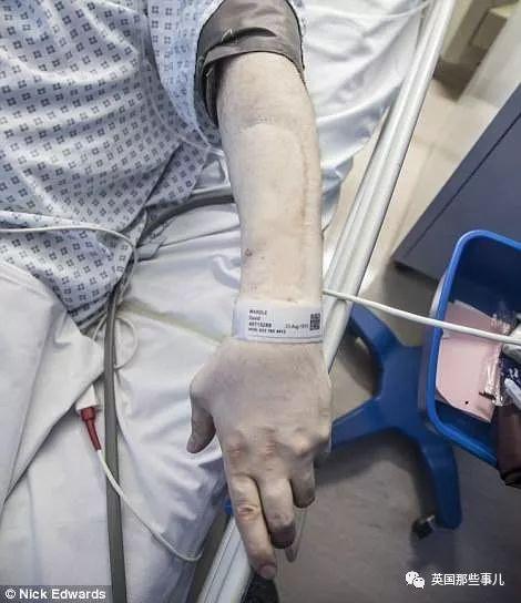 一出生就没了12个器官,一出生就没有肚脐