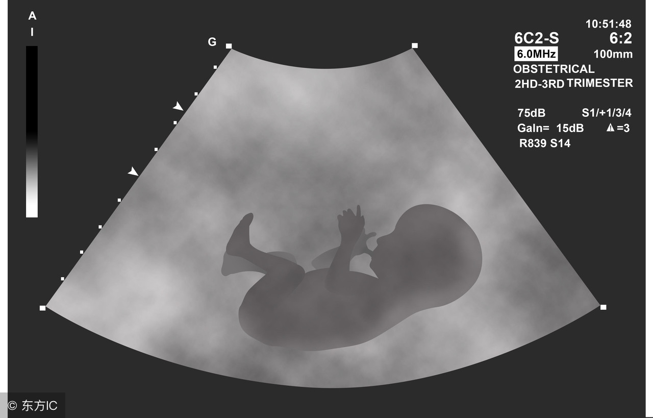 孕妇产检项目及时间表和价格,孕期产检项目一览表及费用怎么做