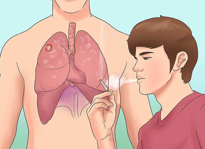 抽烟30年得肺癌的几率,二十年烟龄得肺癌几率