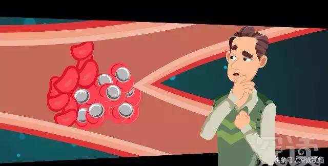 紧急救援脑梗,脑梗溶栓护理科普动画通俗易懂