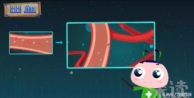 紧急救援脑梗,脑梗溶栓护理科普动画通俗易懂