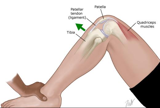 膝关节韧带损伤最佳治疗方法,膝关节韧带损伤有啥治疗秘方吗