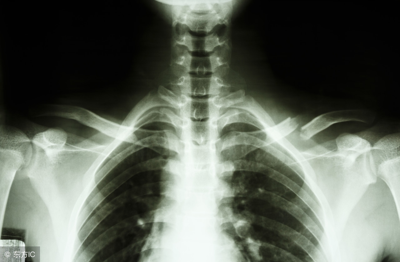 小孩子骨折不可以用药吗,小孩有点骨折不打石膏可以吗