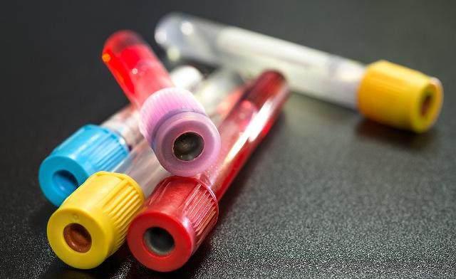 “受孕成功”几天可以检测出来？可能是这个时间，你了解吗？