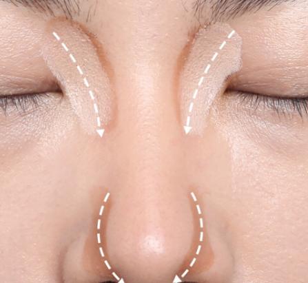 为什么有人的鼻子那么小,鼻子不够挺是什么原因