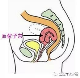 子宫的位置影响试管吗,怀孕四个月子宫位置