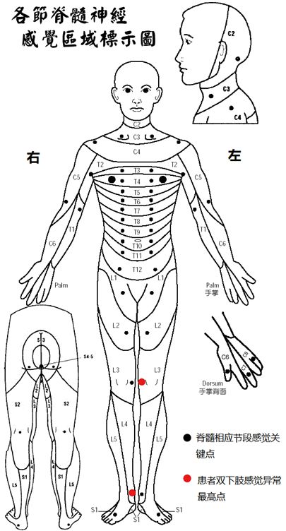 美国脊髓损伤新消息,脊髓损伤有什么症状吃什么药最好
