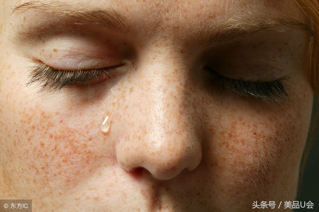 斑点为什么会长,为什么斑点很难去除