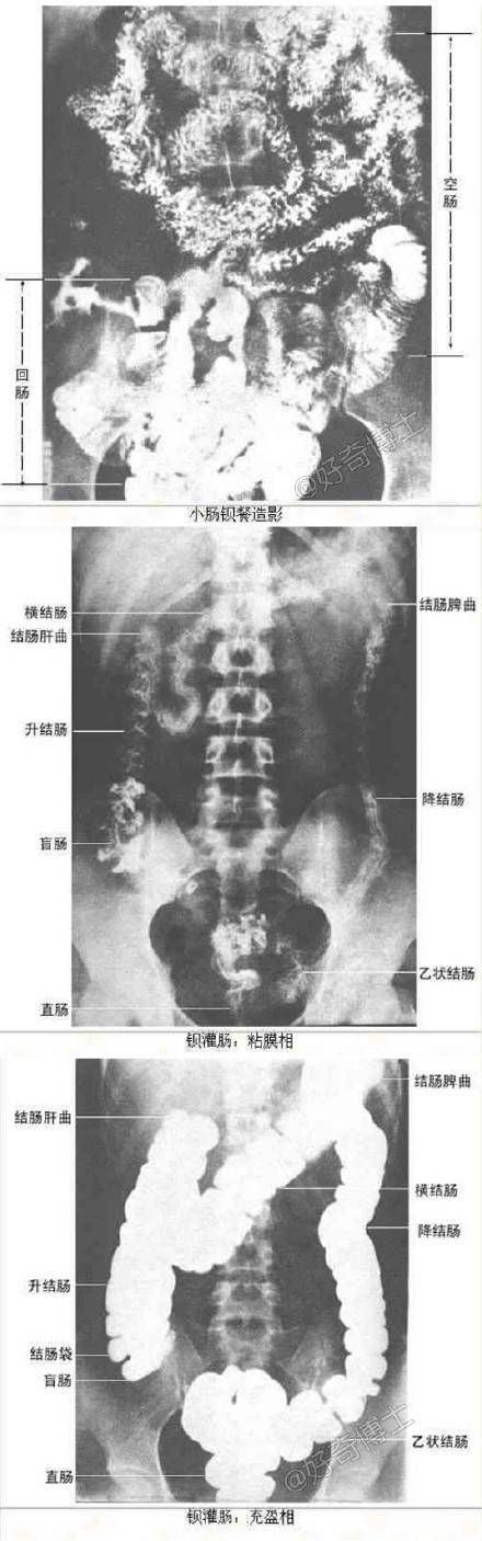 教你如何看X线片子的最全整理