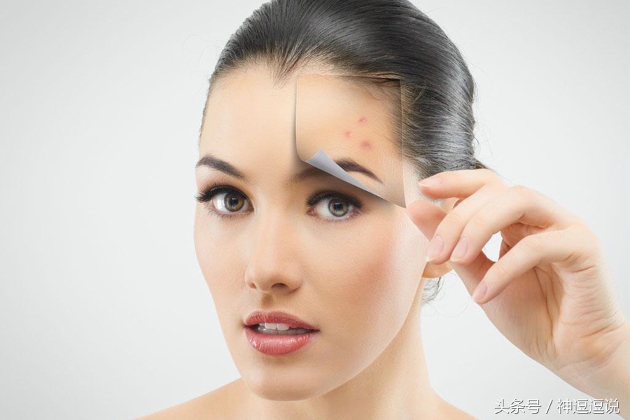 有痘印该怎么办,有痘印用什么水乳