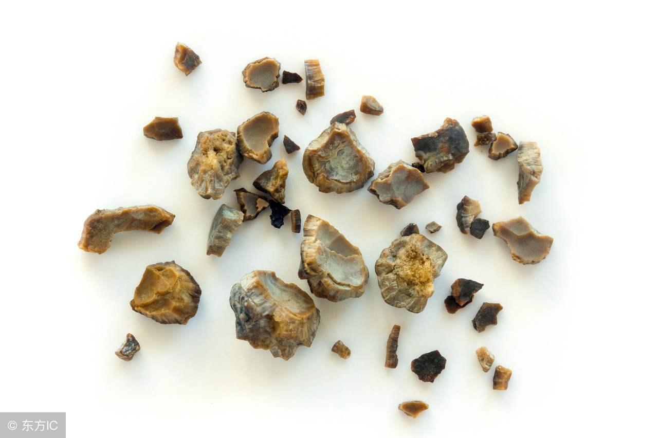 肾结石激光碎石的危害和副作用,肾结石冲击波碎石后的护理