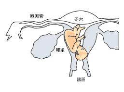 输卵管臭氧介入治疗和造影剂,介入治疗输卵管堵塞需要打麻药嘛